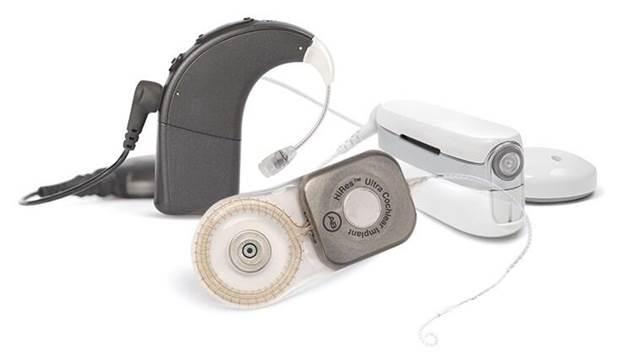 Cochlear Implant